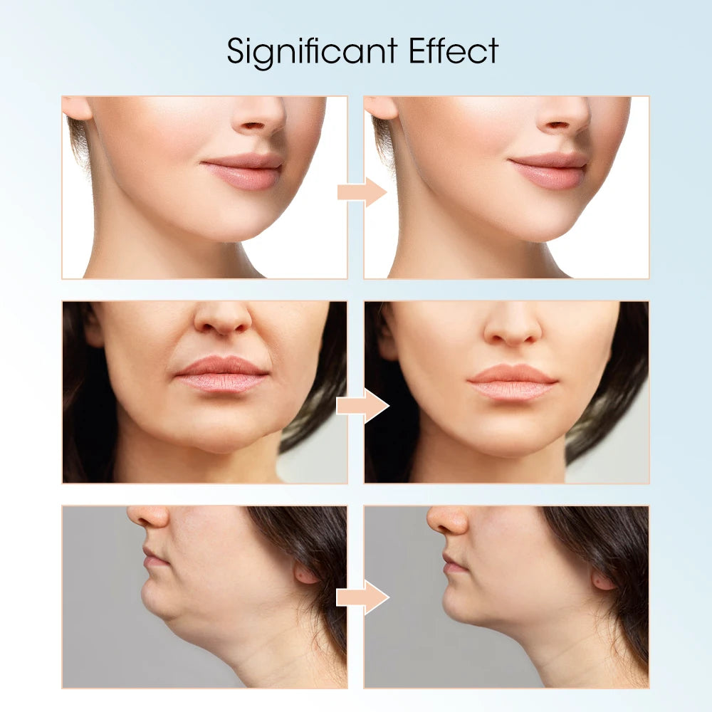 Rechargeable V Face Massager, Portable Facial Massage Device, LED Display, Facial Beauty Instrument